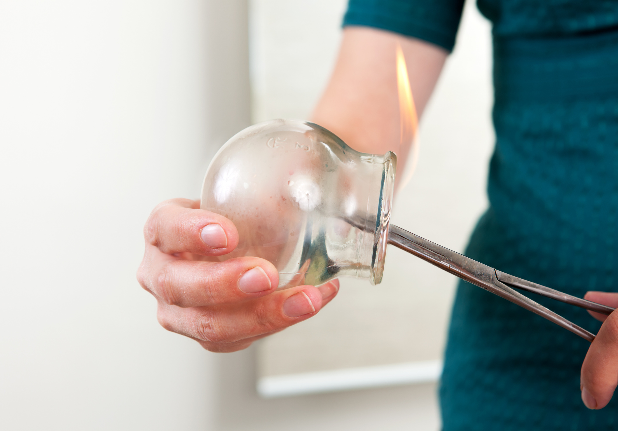 Acupuncture Cupping Bulb Detail